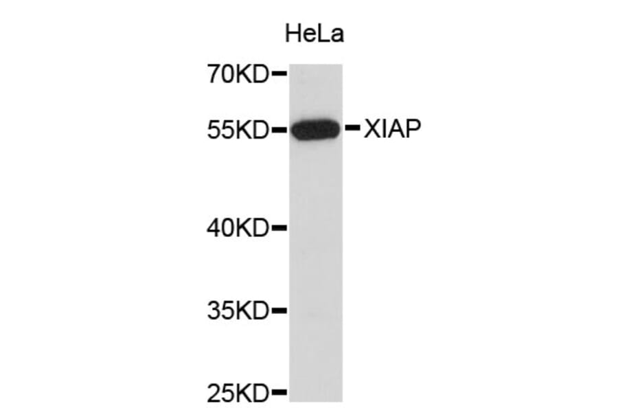 Western Blot - Anti-XIAP Antibody (A3735) - Antibodies.com