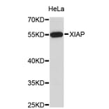 Western Blot - Anti-XIAP Antibody (A3735) - Antibodies.com