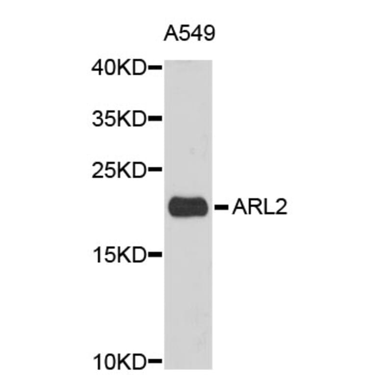 Western Blot - Anti-ARL2 Antibody (A3742) - Antibodies.com