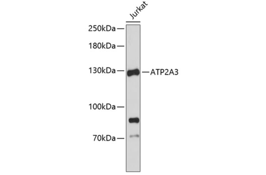 Western Blot - Anti-ATP2A3 Antibody (A3748) - Antibodies.com