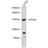 Western Blot - Anti-ATP2A3 Antibody (A3748) - Antibodies.com