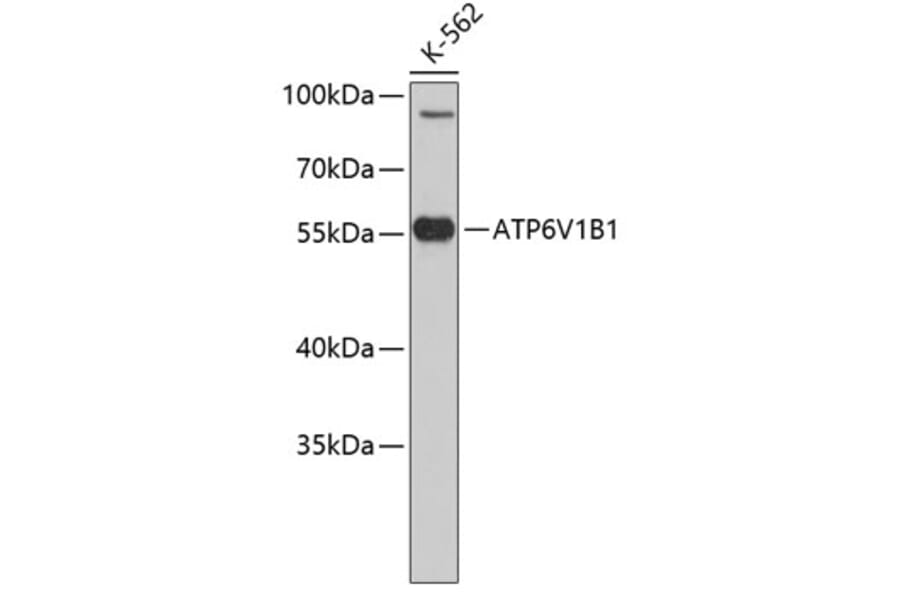 Western Blot - Anti-ATP6V1B1 Antibody (A3753) - Antibodies.com