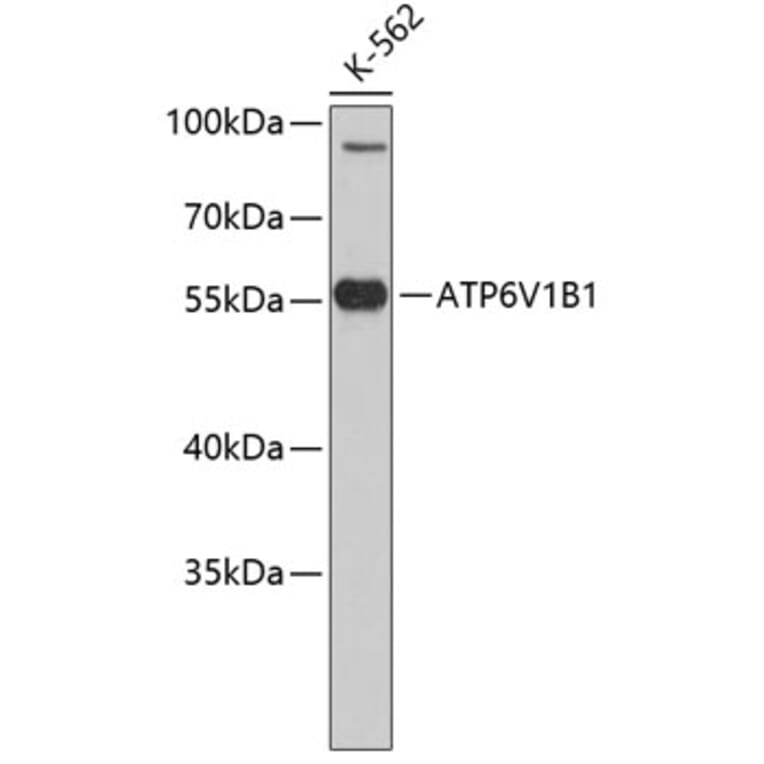Western Blot - Anti-ATP6V1B1 Antibody (A3753) - Antibodies.com