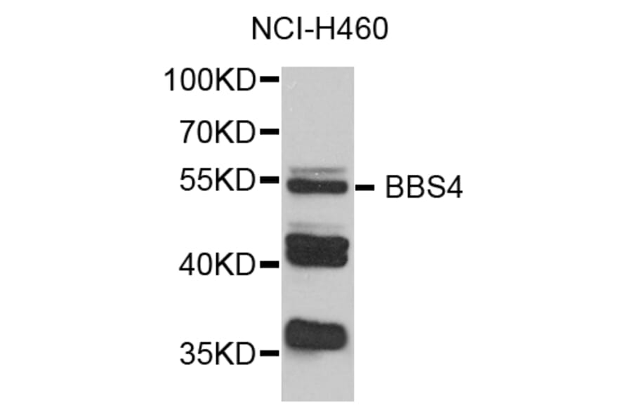 Western Blot - Anti-BBS4 Antibody (A3759) - Antibodies.com