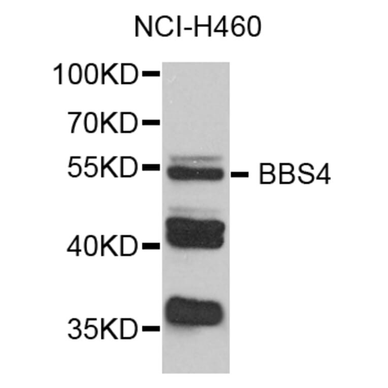 Western Blot - Anti-BBS4 Antibody (A3759) - Antibodies.com