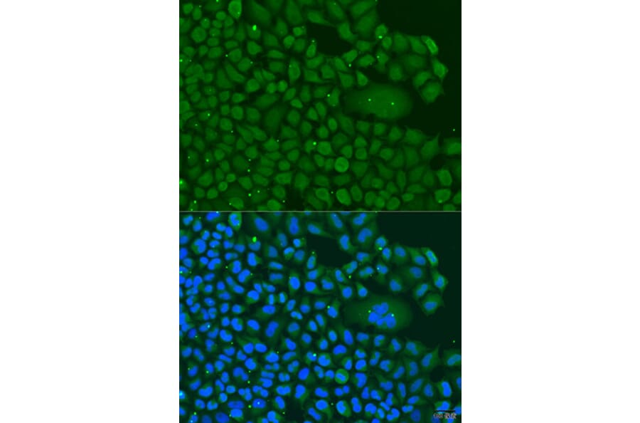 Immunofluorescence - Anti-BBS4 Antibody (A3759) - Antibodies.com