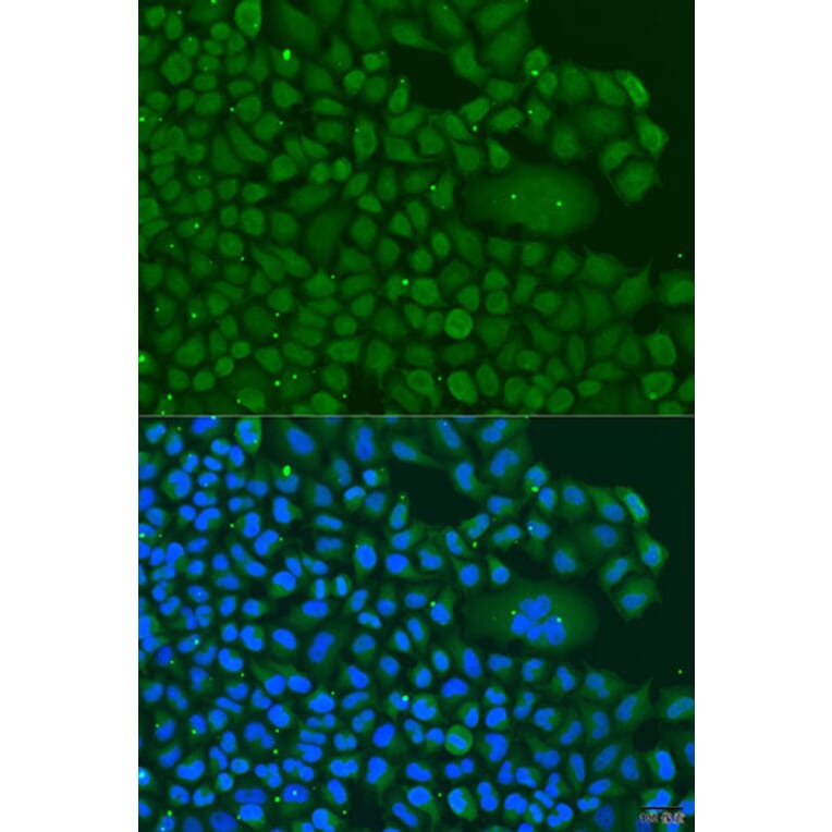 Immunofluorescence - Anti-BBS4 Antibody (A3759) - Antibodies.com