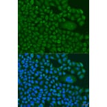 Immunofluorescence - Anti-BBS4 Antibody (A3759) - Antibodies.com