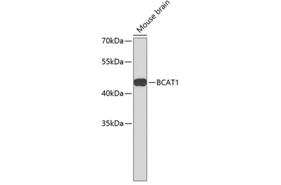 Western Blot - Anti-BCAT1 Antibody (A3760) - Antibodies.com