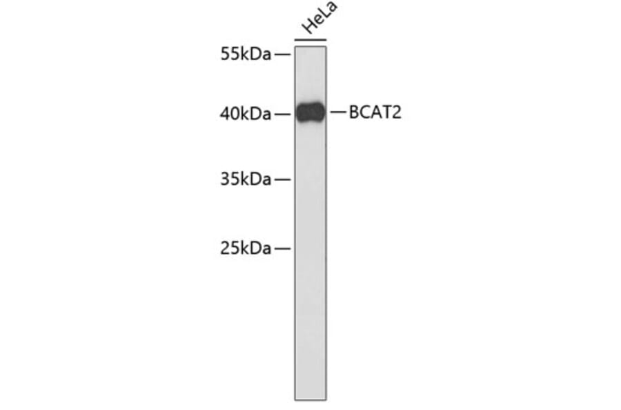 Western Blot - Anti-BCAT2 Antibody (A3761) - Antibodies.com