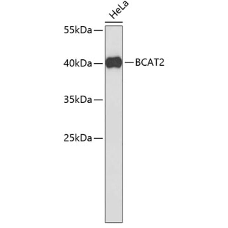 Western Blot - Anti-BCAT2 Antibody (A3761) - Antibodies.com