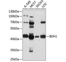 Western Blot - Anti-BDH1 Antibody (A9282) - Antibodies.com