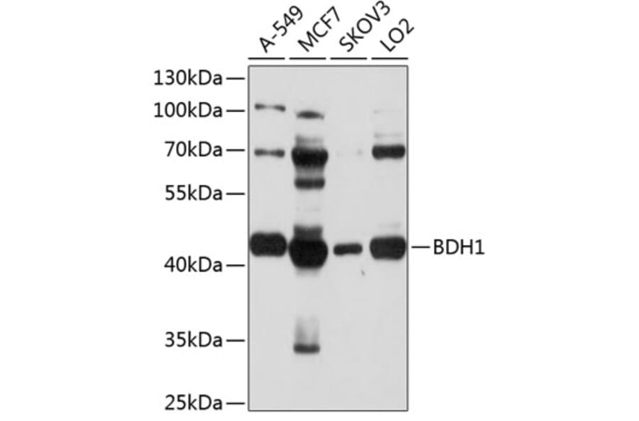 Western Blot - Anti-BDH1 Antibody (A9282) - Antibodies.com