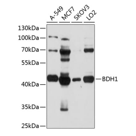Western Blot - Anti-BDH1 Antibody (A9282) - Antibodies.com