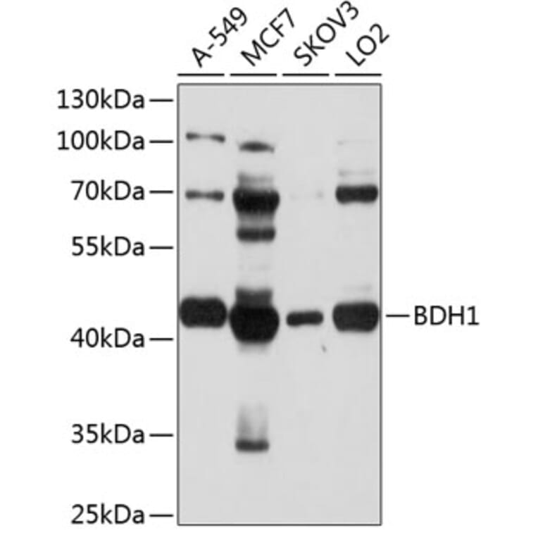 Western Blot - Anti-BDH1 Antibody (A9282) - Antibodies.com