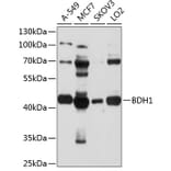 Western Blot - Anti-BDH1 Antibody (A9282) - Antibodies.com