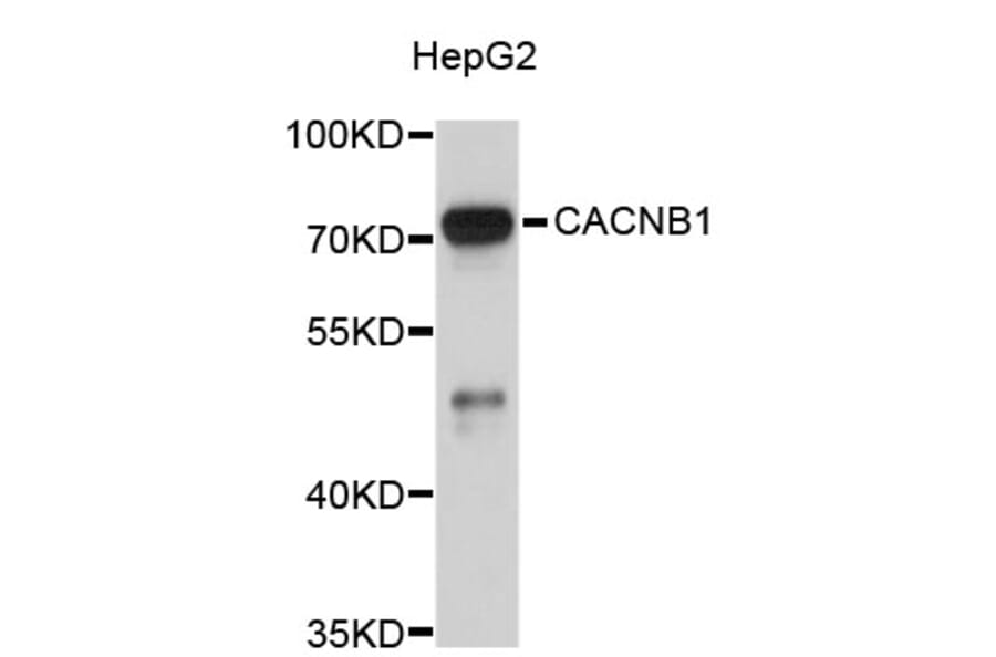 Western Blot - Anti-CACNB1 Antibody (A3771) - Antibodies.com