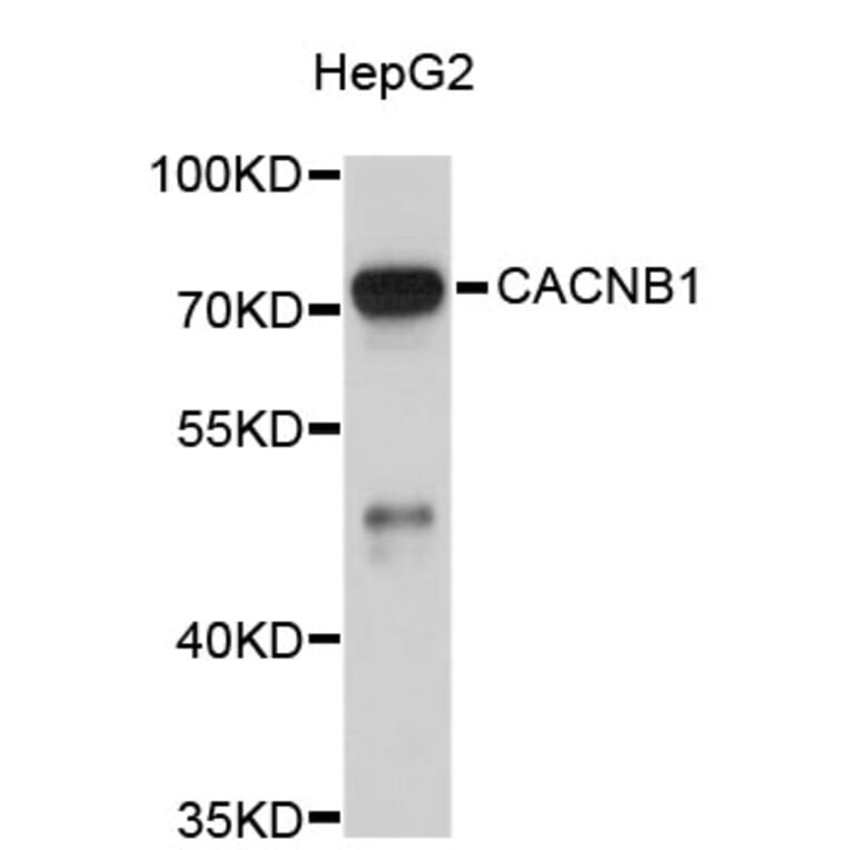 Western Blot - Anti-CACNB1 Antibody (A3771) - Antibodies.com