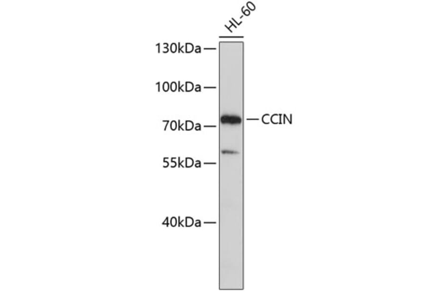 Western Blot - Anti-CCIN Antibody (A3777) - Antibodies.com