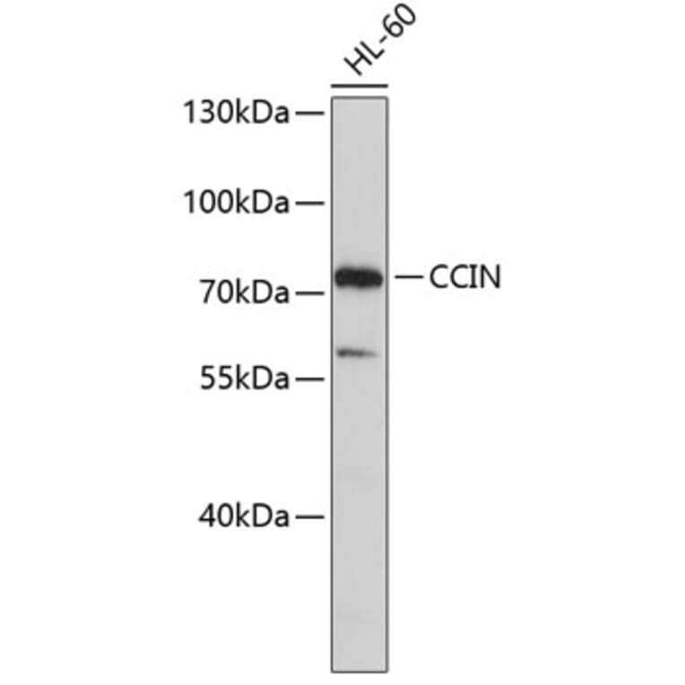 Western Blot - Anti-CCIN Antibody (A3777) - Antibodies.com