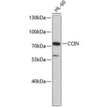 Western Blot - Anti-CCIN Antibody (A3777) - Antibodies.com