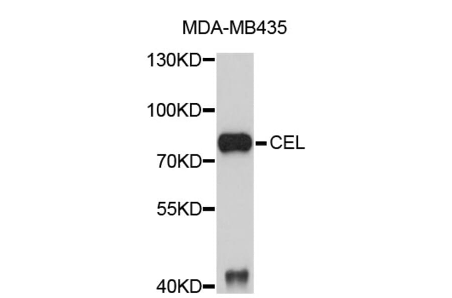 Western Blot - Anti-CEL Antibody (A3783) - Antibodies.com