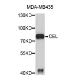 Western Blot - Anti-CEL Antibody (A3783) - Antibodies.com
