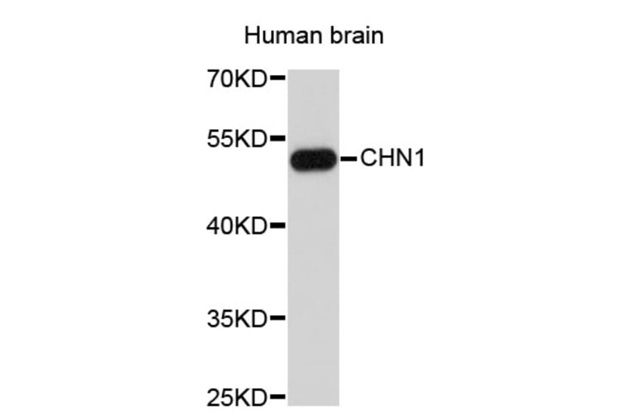 Western Blot - Anti-CHN1 Antibody (A3786) - Antibodies.com