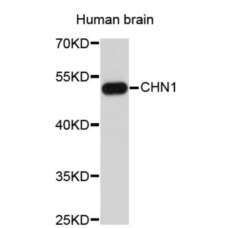 Western Blot - Anti-CHN1 Antibody (A3786) - Antibodies.com