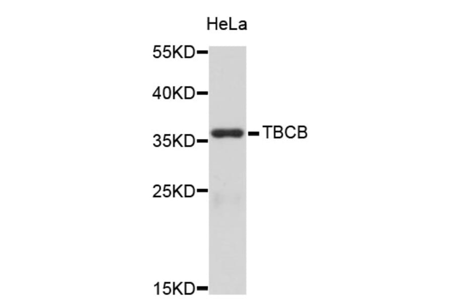 Western Blot - Anti-TBCB Antibody (A3789) - Antibodies.com
