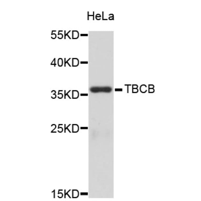Western Blot - Anti-TBCB Antibody (A3789) - Antibodies.com