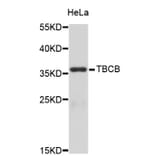 Western Blot - Anti-TBCB Antibody (A3789) - Antibodies.com