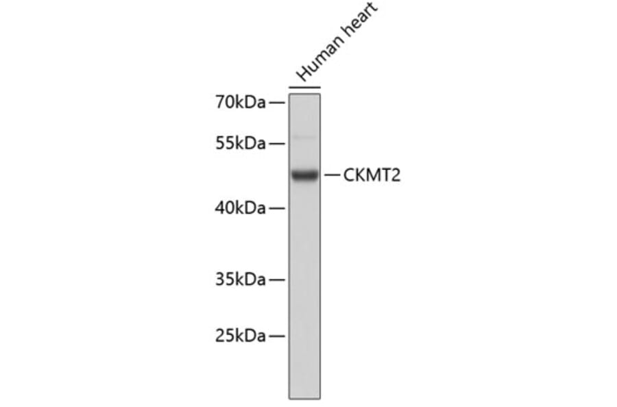 Western Blot - Anti-CKMT2 Antibody (A3790) - Antibodies.com