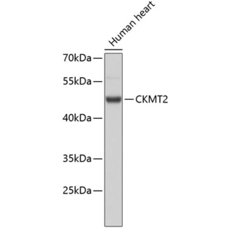 Western Blot - Anti-CKMT2 Antibody (A3790) - Antibodies.com