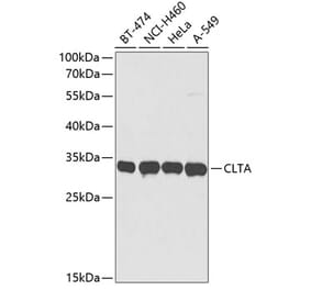 Western Blot - Anti-Clathrin light chain Antibody (A9292) - Antibodies.com
