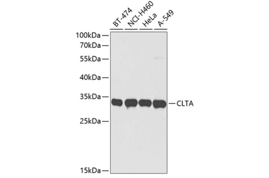 Western Blot - Anti-Clathrin light chain Antibody (A9292) - Antibodies.com