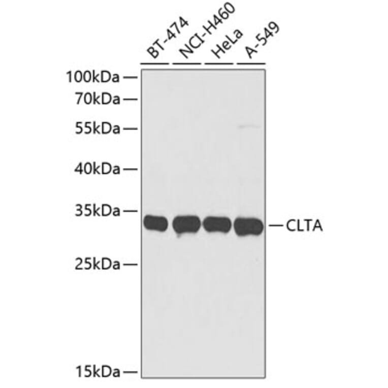 Western Blot - Anti-Clathrin light chain Antibody (A9292) - Antibodies.com