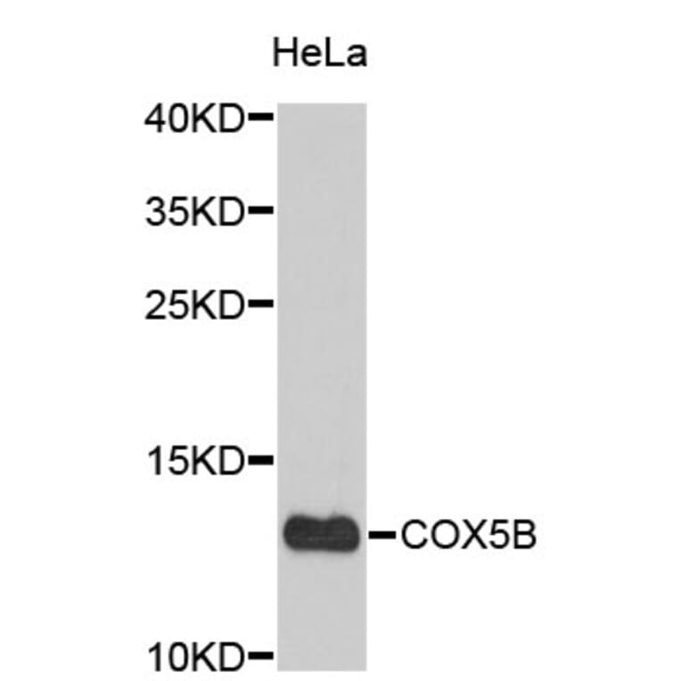 Western Blot - Anti-COX5B Antibody (A3797) - Antibodies.com