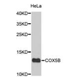 Western Blot - Anti-COX5B Antibody (A3797) - Antibodies.com