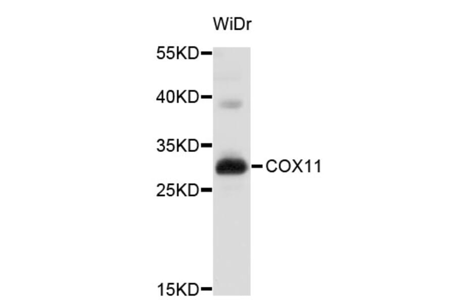 Western Blot - Anti-COX11 Antibody (A3801) - Antibodies.com