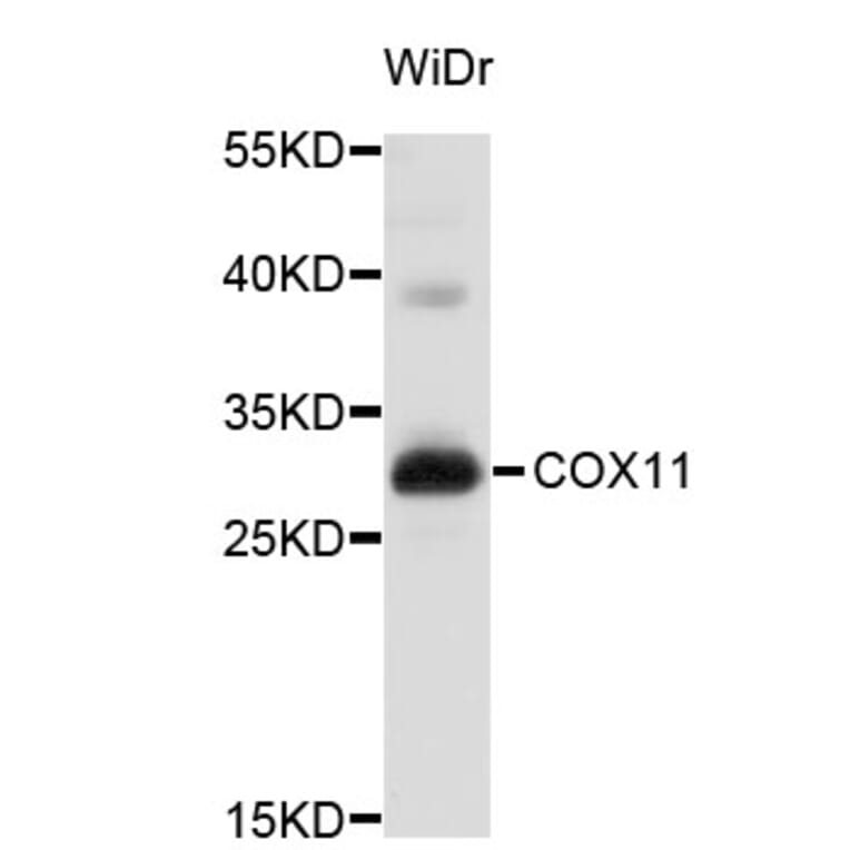 Western Blot - Anti-COX11 Antibody (A3801) - Antibodies.com