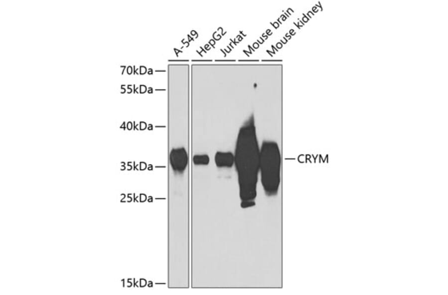 Western Blot - Anti-mu Crystallin Antibody (A9296) - Antibodies.com