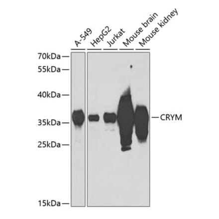 Western Blot - Anti-mu Crystallin Antibody (A9296) - Antibodies.com