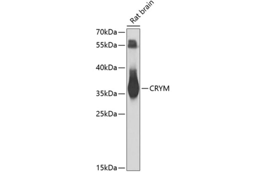 Western Blot - Anti-mu Crystallin Antibody (A9296) - Antibodies.com