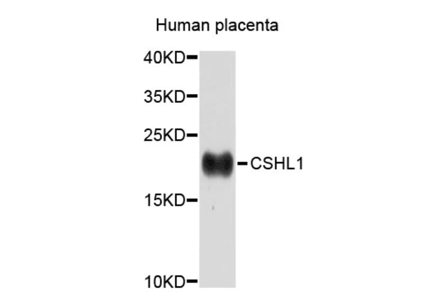 Western Blot - Anti-CSHL1 Antibody (A3811) - Antibodies.com