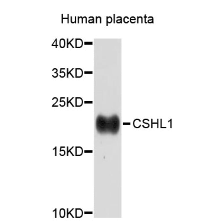 Western Blot - Anti-CSHL1 Antibody (A3811) - Antibodies.com
