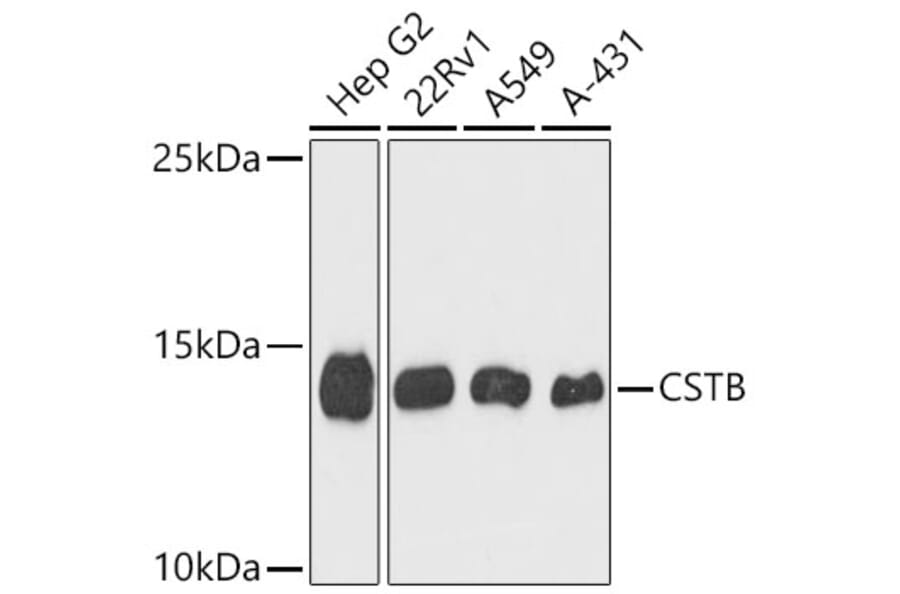 Western Blot - Anti-Cystatin B Antibody (A9299) - Antibodies.com
