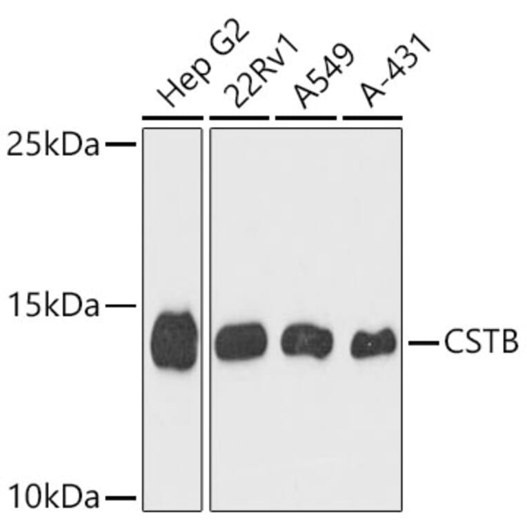 Western Blot - Anti-Cystatin B Antibody (A9299) - Antibodies.com