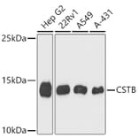 Western Blot - Anti-Cystatin B Antibody (A9299) - Antibodies.com