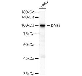 Western Blot - Anti-DAB2 Antibody (A9300) - Antibodies.com